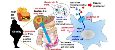 多孔细胞导致肝脏变差