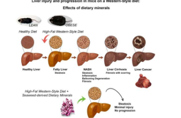 矿物质补充剂可以阻止脂肪肝疾病的进展