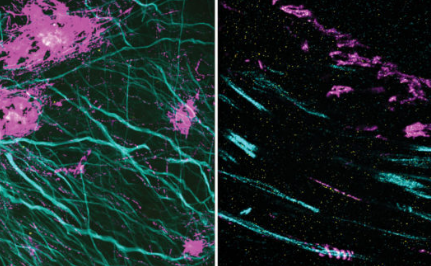 显微镜技术揭示了细胞和组织中隐藏的纳米结构