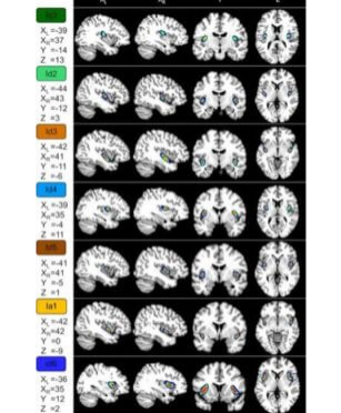 研究人员在人脑中发现了七个新区域