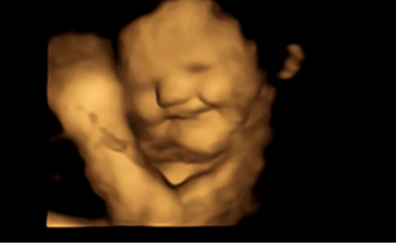 第一个很好的证据表明婴儿对味觉和子宫内的嗅觉有反应
