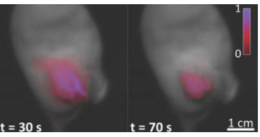 延迟荧光作为一种有效切除肿瘤的成像方法