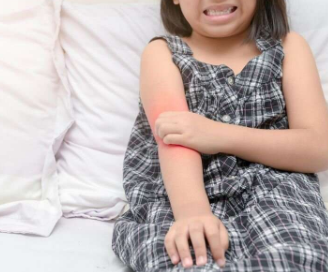 一年级的轻度湿疹可能会在六年级时消退