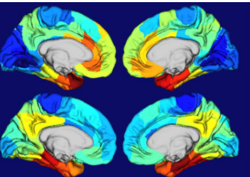 研究提供了关于为什么阿尔茨海默病会损害大脑某些部位的线索