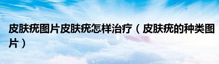 皮肤疣图片皮肤疣怎样治疗（皮肤疣的种类图片）