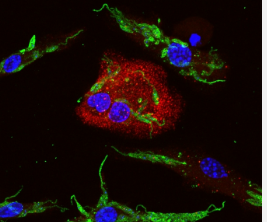 研究表明利什曼原虫操纵生物体的防御系统继续复制