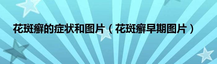 花斑癣的症状和图片（花斑癣早期图片）