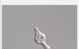发现一种新的动物寄生虫种筑波寄生虫