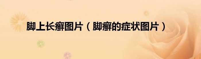脚上长癣图片（脚癣的症状图片）
