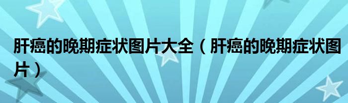 肝癌的晚期症状图片大全（肝癌的晚期症状图片）