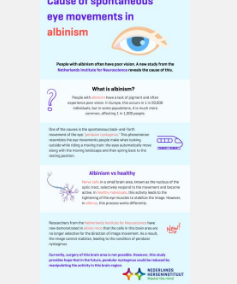 是什么导致白化病患者自发性眼球运动