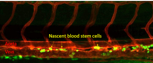 创造造血干细胞的关键可能在于您自己的血液