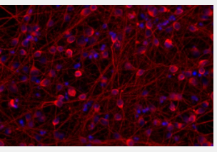 MSK斯隆研究人员破解神经元的内部时钟以加速神经系统疾病的研究