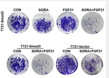 SORA联合FGF21通过Smad3抑制HCC细胞生长并促进凋亡