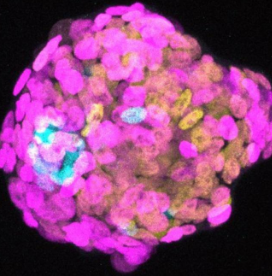 新的培养系统发现早期人类胚胎中的细胞拥挤程度影响细胞身份决策
