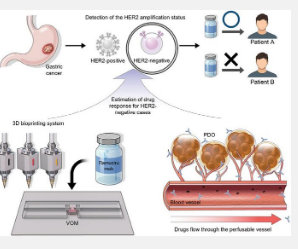 通过个性化3D生物打印彻底改变胃癌治疗