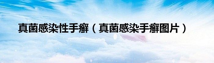 真菌感染性手癣（真菌感染手癣图片）