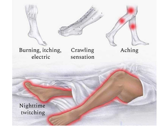科学家找到治疗不安腿综合征的方法