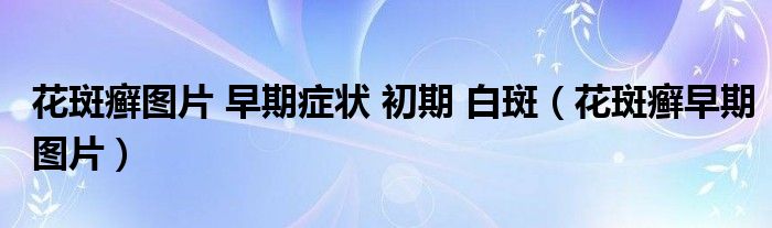 花斑癣图片 早期症状 初期 白斑（花斑癣早期图片）